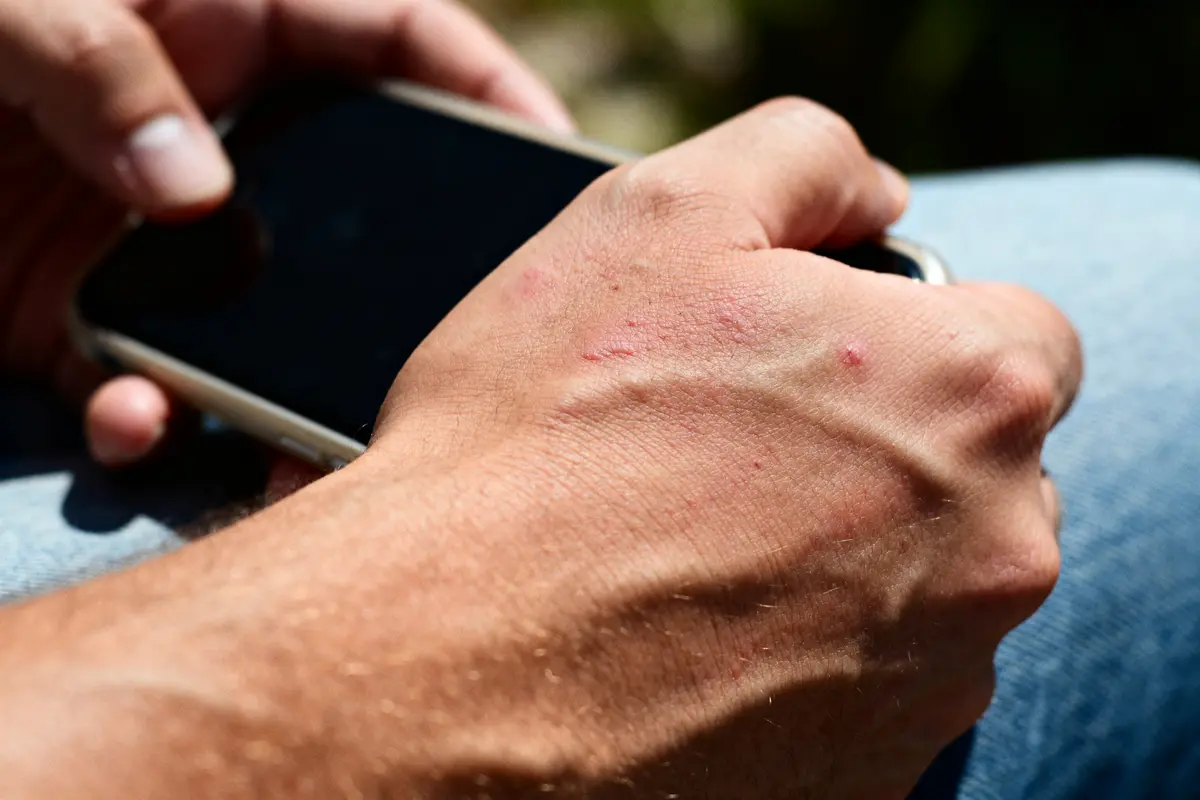 Cuir chevelu qui gratte : causes, soins efficaces et solutions