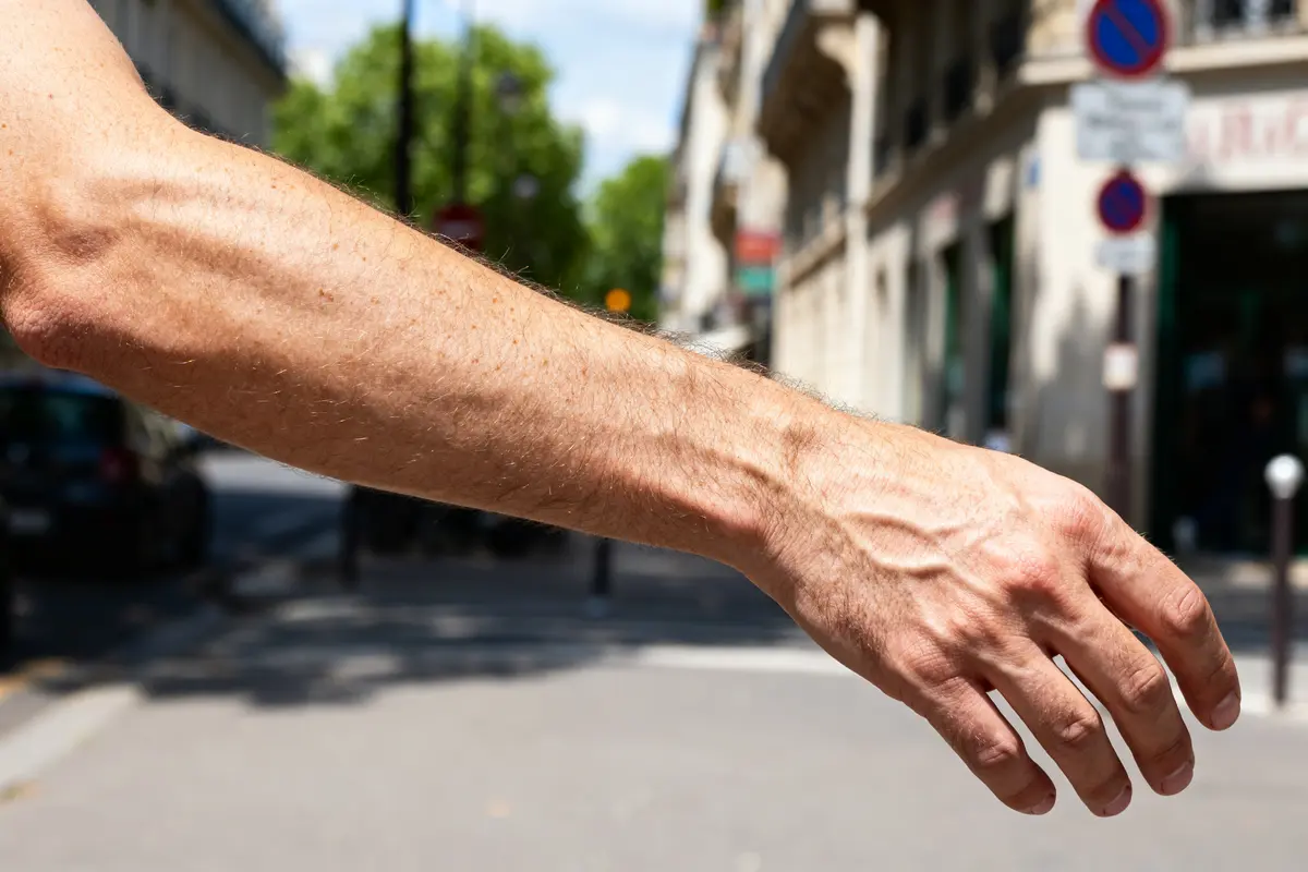 Bras droit engourdi : causes, symptômes et que faire ?